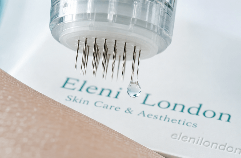 Collagen Induction Therapy: How Skin Trauma Triggers Renewal