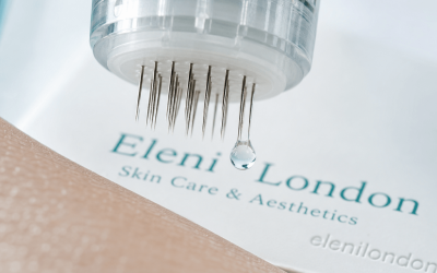 Collagen Induction Therapy: How Skin Trauma Triggers Renewal