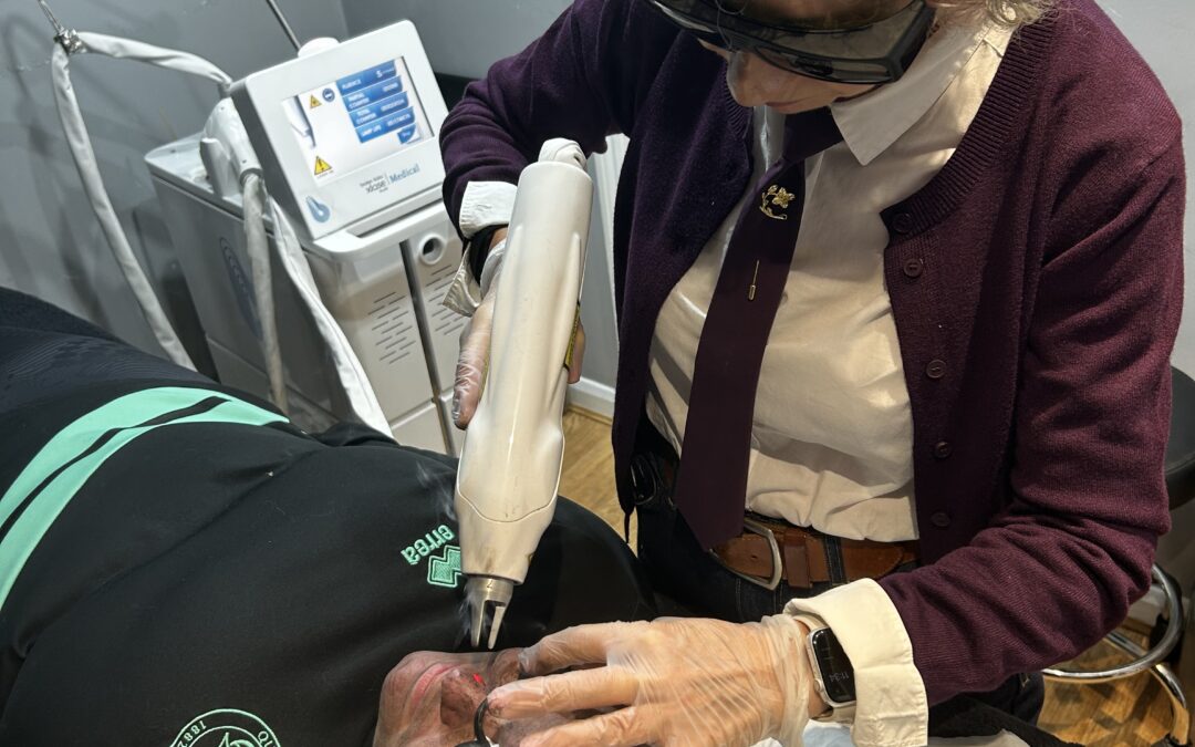 XLASE PLUS Advanced Skin Resurfacing at Eleni London
