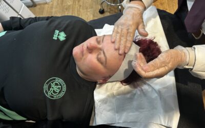 Plasma Skin Tightening Near London